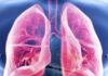 जाने निमोनिया कैसे हैं खतरनाक और क्या है इसका इलाज और बचाव का तरीका